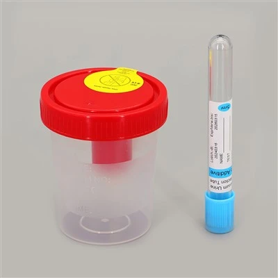 Pov tseg Urine Specimen Collection Cup With Screw Cap